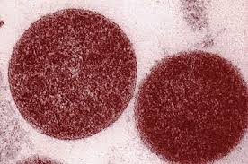 Nhiễm khuẩn tăng bạch cầu đơn nhân - Hình ảnh minh họa